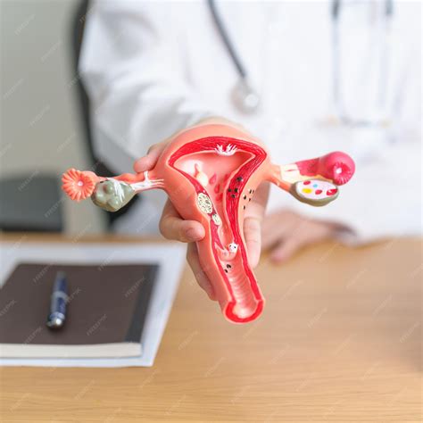 Colo Do Utero Anatomia - Médico com modelo de anatomia do útero e dos ovários Cancro ovariano e ...