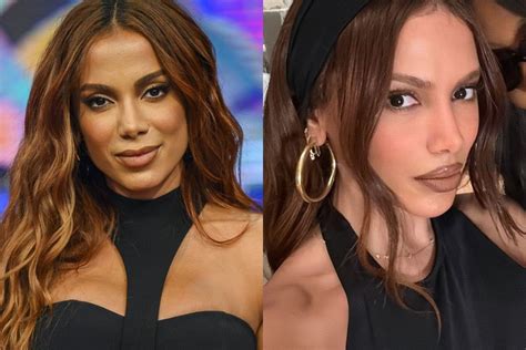 Anitta Antes E Depois Da Harmonização Facial