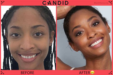 The forum candid io Transformation: Before & After - jgprc09