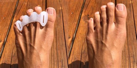 toe spacers game changing hack  gimmick motus physical therapy