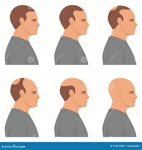 Bolding Cartoons, Illustrations & Vector Stock Images - 24 Pictures to