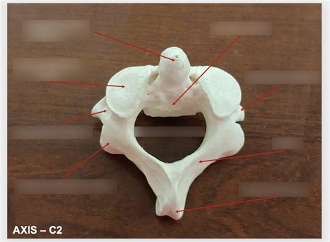 vertebrae #2 Diagram | Quizlet