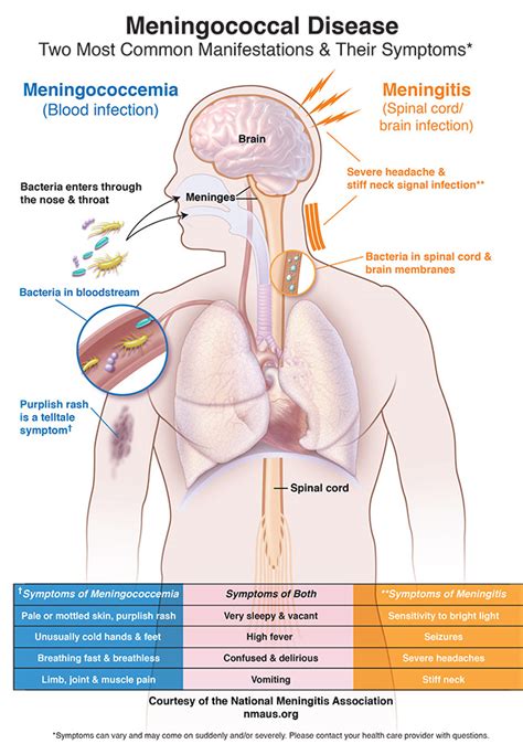 symptoms nma