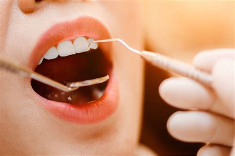 Extraction Process | America Dental