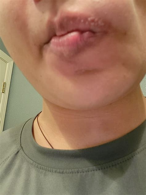 Strange bumps : r/MedicalHelp