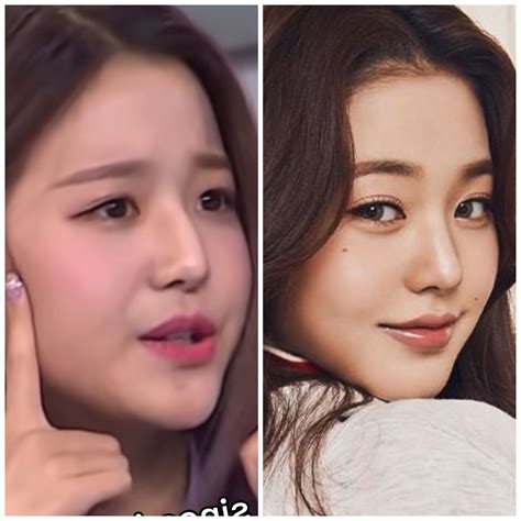 Angelababy plastic surgery nose eyes chin job – Artofit