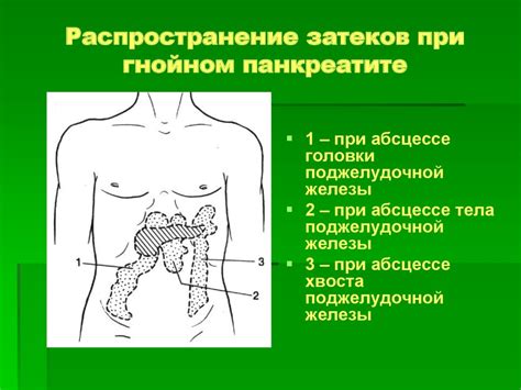 Гнойные процессы в обширных клетчаточных пространствах и в железистых ...