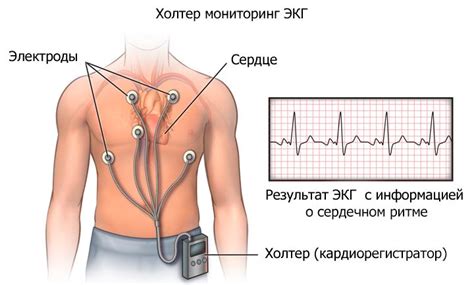 Дефицит пульса: что это такое, определение, почему возникает и лечение