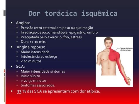O Que É Dor Precordial - Mercredi dor precordial