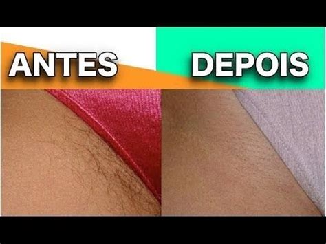 Depilação A Cera Na Virilha - Depilação com Cera Caseira Regiao Intima virilha - YouTube