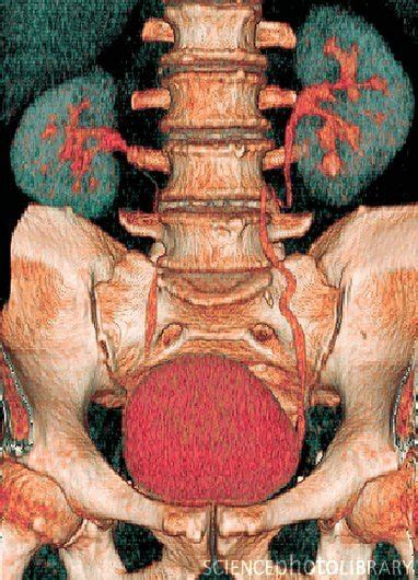 1000+ images about Anatomy - Axial Skeletal System on Pinterest | Axial ...