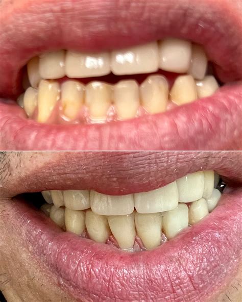 TK Dental Wayne | Dentists Wayne, NJ | Dr. Tatyana Kaminar, DDS