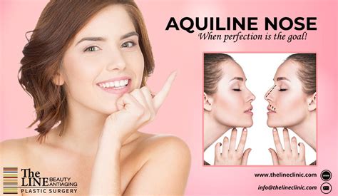 aquiline nose nose shape surgery artofit