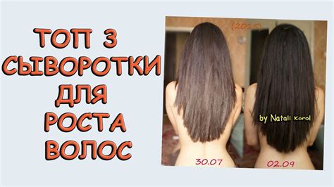 Средство для роста волос / Укрепление волос / ТОП 3 сыворотки - YouTube