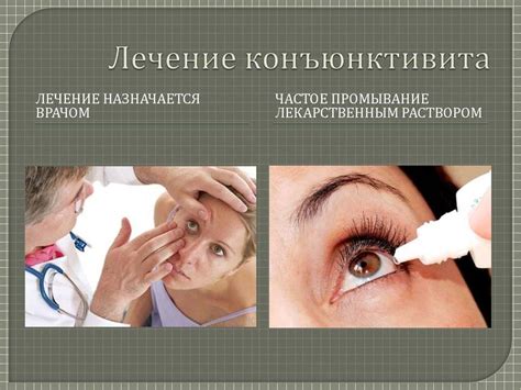 Профилактика конъюнктивита у детей и взрослых: основные правила