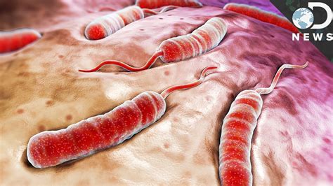 What Exactly Does Cholera Do To Your Body? - YouTube