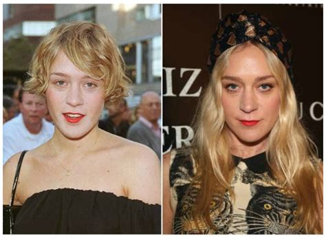 Before-and-After: Celebrity Plastic Surgery Images That Will Make Your ...