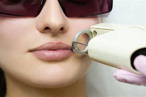 Upper Lip Laser Hair Removal Boca Raton | IconMD