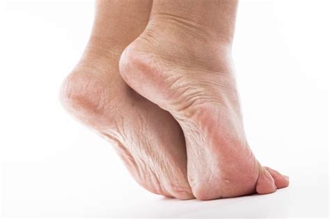 Peripheral Neuropathy | Neuro, Respiratory & Recovery Physiotherapy