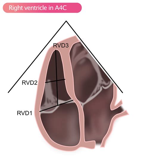 Standard Transthoracic Echocardiogram: Complete Imaging Protocol – ECG