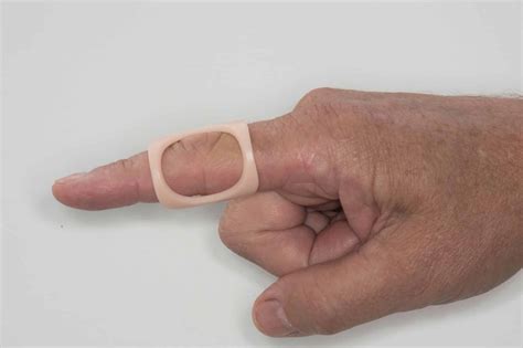 how to fix a crooked finger