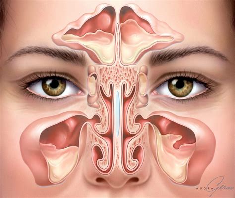 sinusitis geras healthcare productions