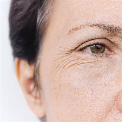 rid   eye wrinkles cascade eye skin centers