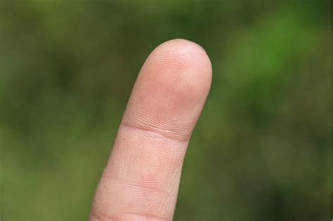 Záhada lidského prstu: Tomu ani vy neuvěříte. Slovák si nepamatuje, jak ...