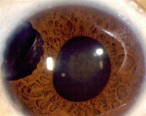 Seriously Messed Up Human Eyes | KLYKER.COM