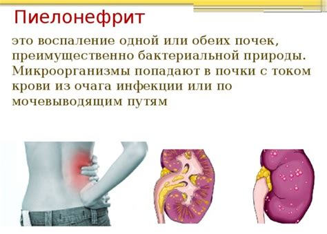Потница у взрослых на фото: какие симптомы и чем лечить