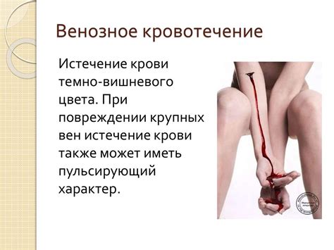 Виды кровотечений. Методы остановки кровотечений - презентация онлайн