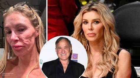 Dr. Dubrow Helps Brandi's FaceDr. Terry Dubrow Is Treating Brandi ...