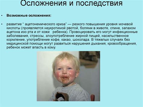 Нервно-артритический диатез - презентация онлайн