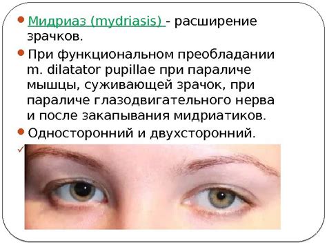Глазодвигательные нервы (III, IV, VI) Этиология