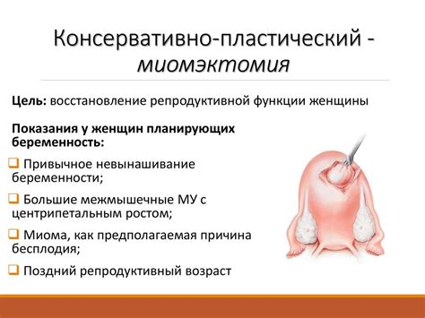 Миома матки - презентация онлайн