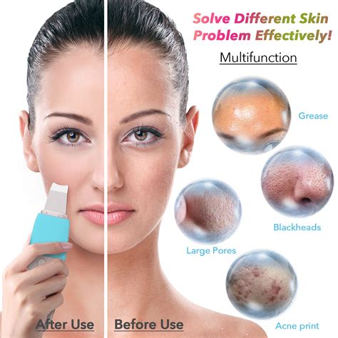 Skin Scrubber Deep Face Cleaning Machine Peeling S... – Grandado