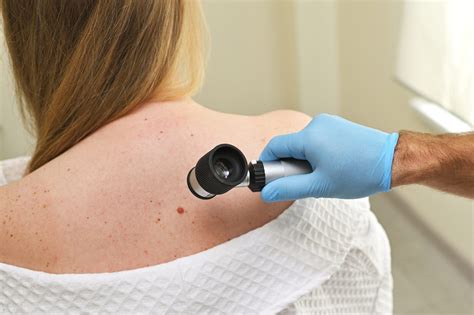 do melanomas blanch