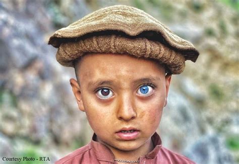 Photos of Afghan child with unique eye colors go viral - Khaama Press