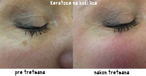 Pin on Prirodno Lečenje Biljem - Lekovi Iz Prirode