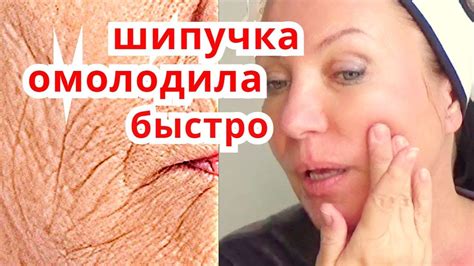 ШИПУЧКА для лица За копейки ! Быстрое Омоложение кожи! Маска От морщин ...