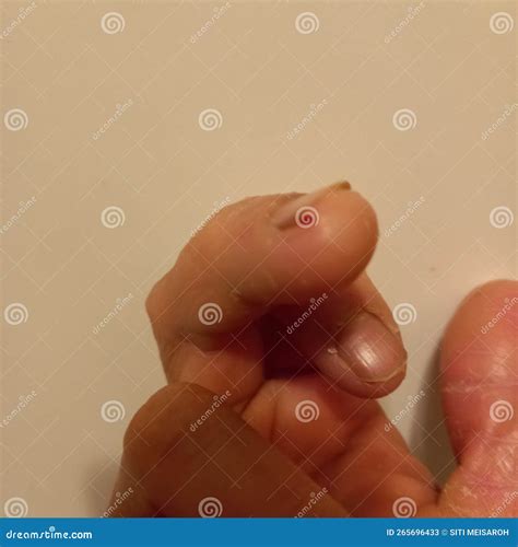 Finger Skin Texture Royalty-Free Stock Photography | CartoonDealer.com