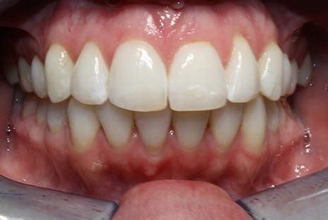 Tooth Talk | Dentist in Bolton, Staffordshire, Southport, Salisbury