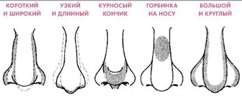 Курносый нос как сделать – Курносый нос – признаки, ринопластика ...