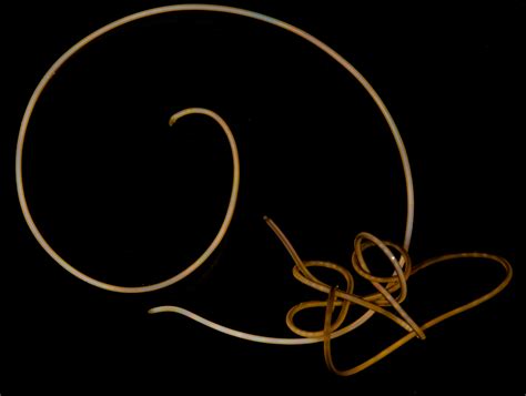 “Mind controlling” parasitic worms are missing genes found in every