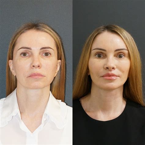 Пластический хирург Татьяна Качанова