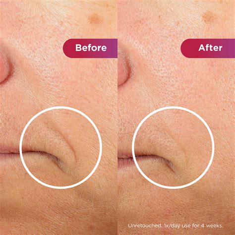 Shark LED Face Mask | Facial Light Therapy – Shark Beauty UK