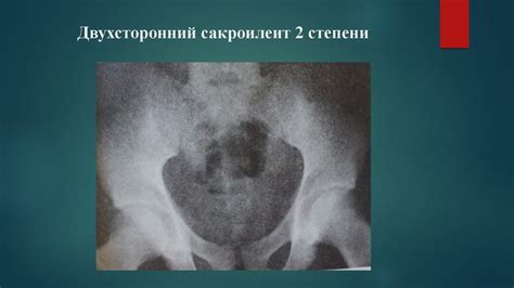 Вопросы визуальной диагностики в ревматологии - презентация онлайн