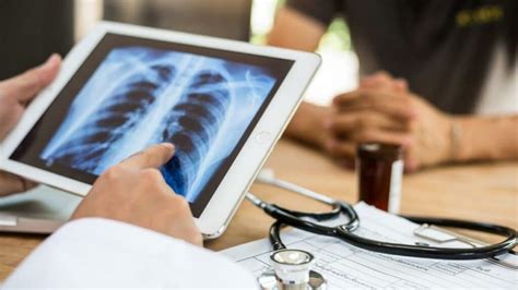 Pulmonary Fibrosis Stages, Prognosis And Life Expectancy