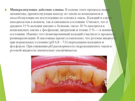Большие слюнные железы - презентация онлайн