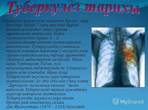 Туберкулез. Туберкулездің алдын алу спецификалық және спецификалық емес ...
